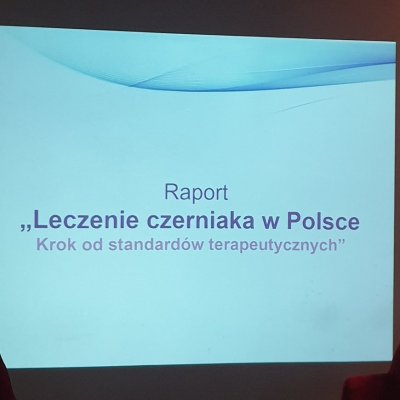 Leczenie czerniaka w Polsce. Krok od standardów terapeutycznych - raport.
